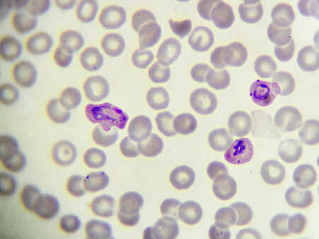 Malaria parasites, microscope, blood