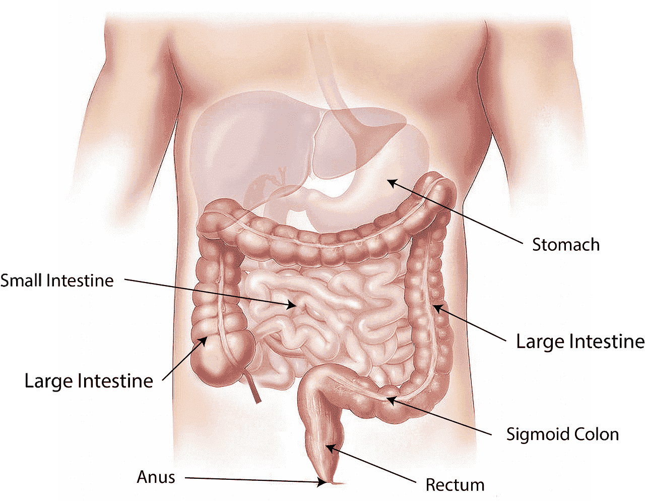 bowel cancer diagram