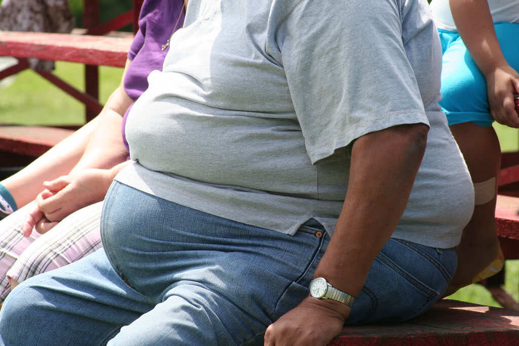 obesity-type2-diabetes