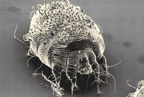 Scabies The Seven Year Itch London Doctors Clinic