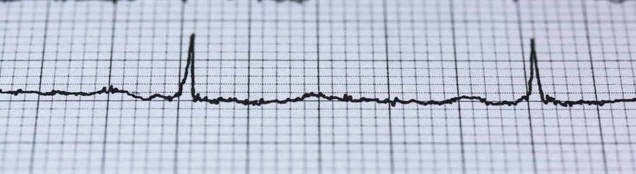 blue heart chart | private cardiologist | London Doctors Clinic